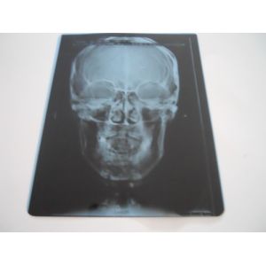 China Professional Dry Imaging Film With Image Layer 14x17inch wholesale