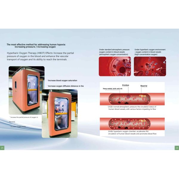 Home Hyperbaric Oxygen Chamber Customized Oxygen Therapy Chambers