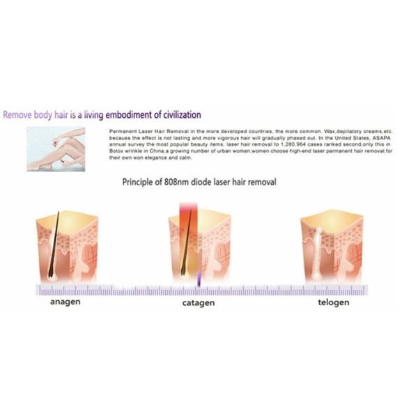 NUBWAY 1800W High Power Permanent Hair Removal Laser Diode Laser Depilation Machine