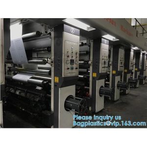 YANTAI BAGEASE DISPOSABLE CONSUMABLES PRODUCTS CO.,LTD.