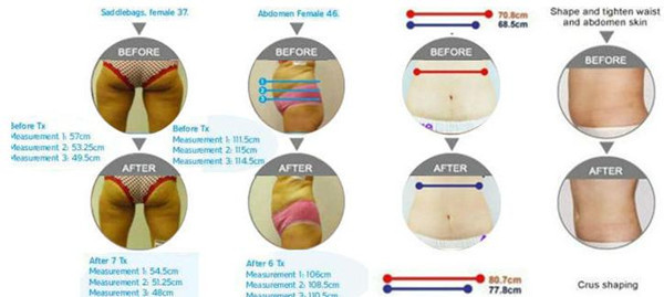 China Top Ten Selling Porducts! 2019 Hot Sale Body Slimming Mutifunction Cryolipolysis cavitation rf slim machine