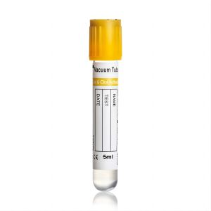 China 3ml,4ml,5ml,10ml Medical Use Disposable Top Gel And Clot Activator Sst Lab Vacuum Blood Collection Tube on sale