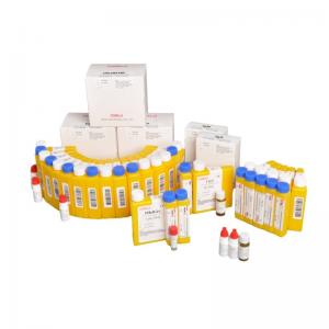 China CNAS Clinical Diagnostic Reagents Chemistry For Renal Clinical Analyzer wholesale