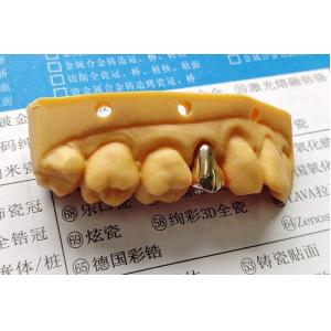 China High Noble Gold Full Metal Dental Crown on sale