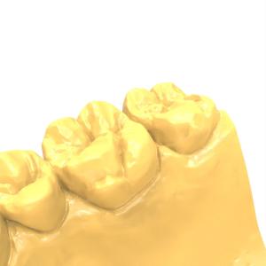 Gray 3d Dental Resin ASTM D256 ASTM D2204 Standards