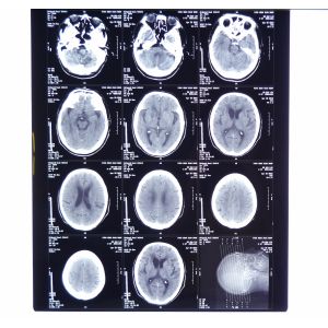 China Hospital Clear Medical X-Ray Film Konida With Thermal Printers wholesale