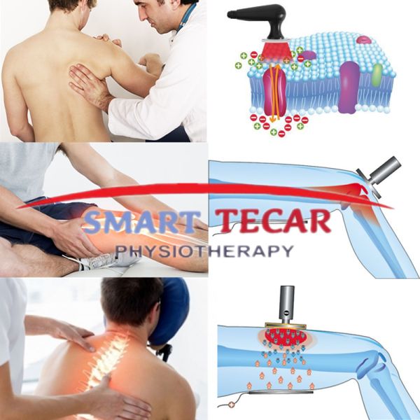 Sport Injury Physical Tecar Therapy Machine For Musclies Adn Myalgia