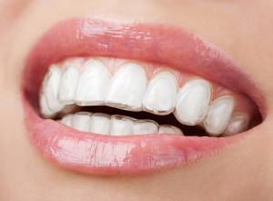 China 17*18cm TPU Transparent Dental Sheet Anti Fouling Tooth Orthodontics Material wholesale