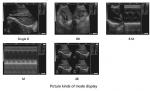 5.8 inch Mobile Ultrasound Machine Fetal Doppler scanner FarmScan® L60 human