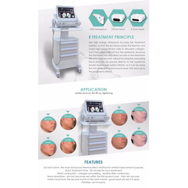 OEM and ODM Hifu machine With 7 traetment heads High Frequency 7Mhz HIFU Equipment