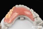 Elaborate Technology For Stable Oral Structure Framework Set Up Teeth Finish In